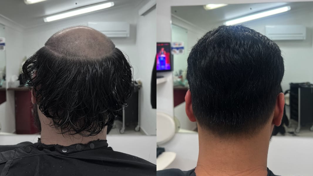Back view before an after shot of man with improved hair