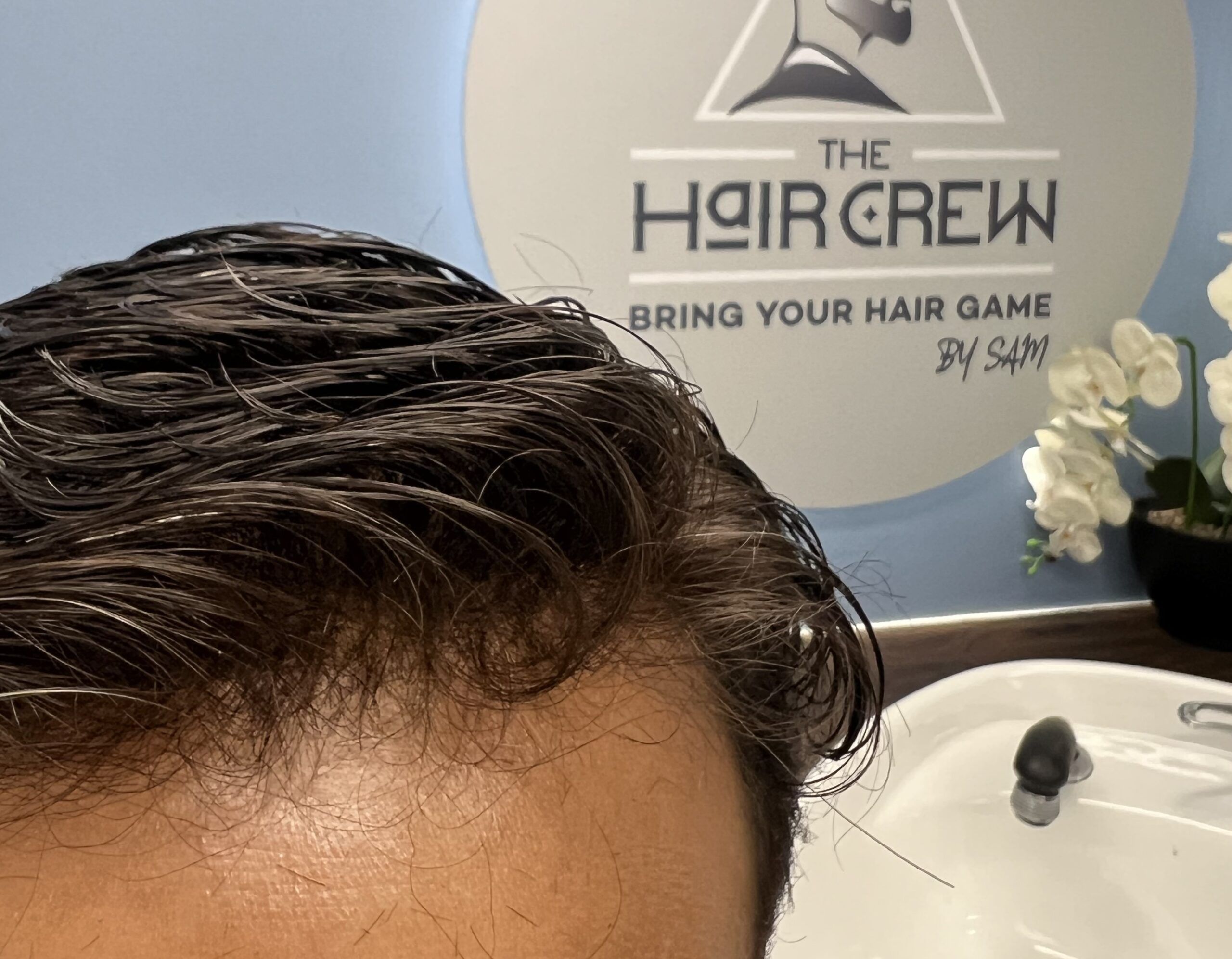 Closeup shot of natural hairline from The Hair Crew's hair system